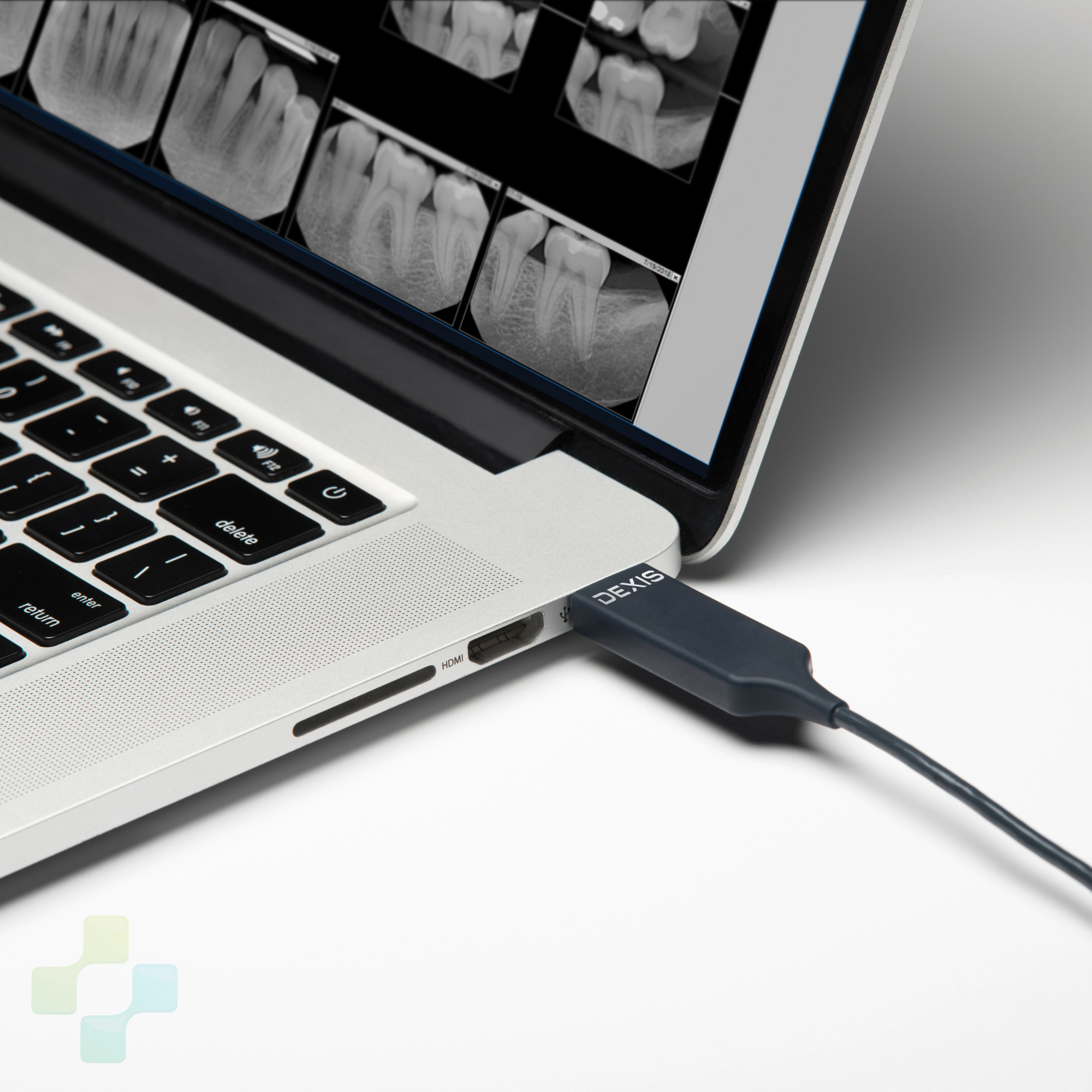 DEXIS Titanium Sensor