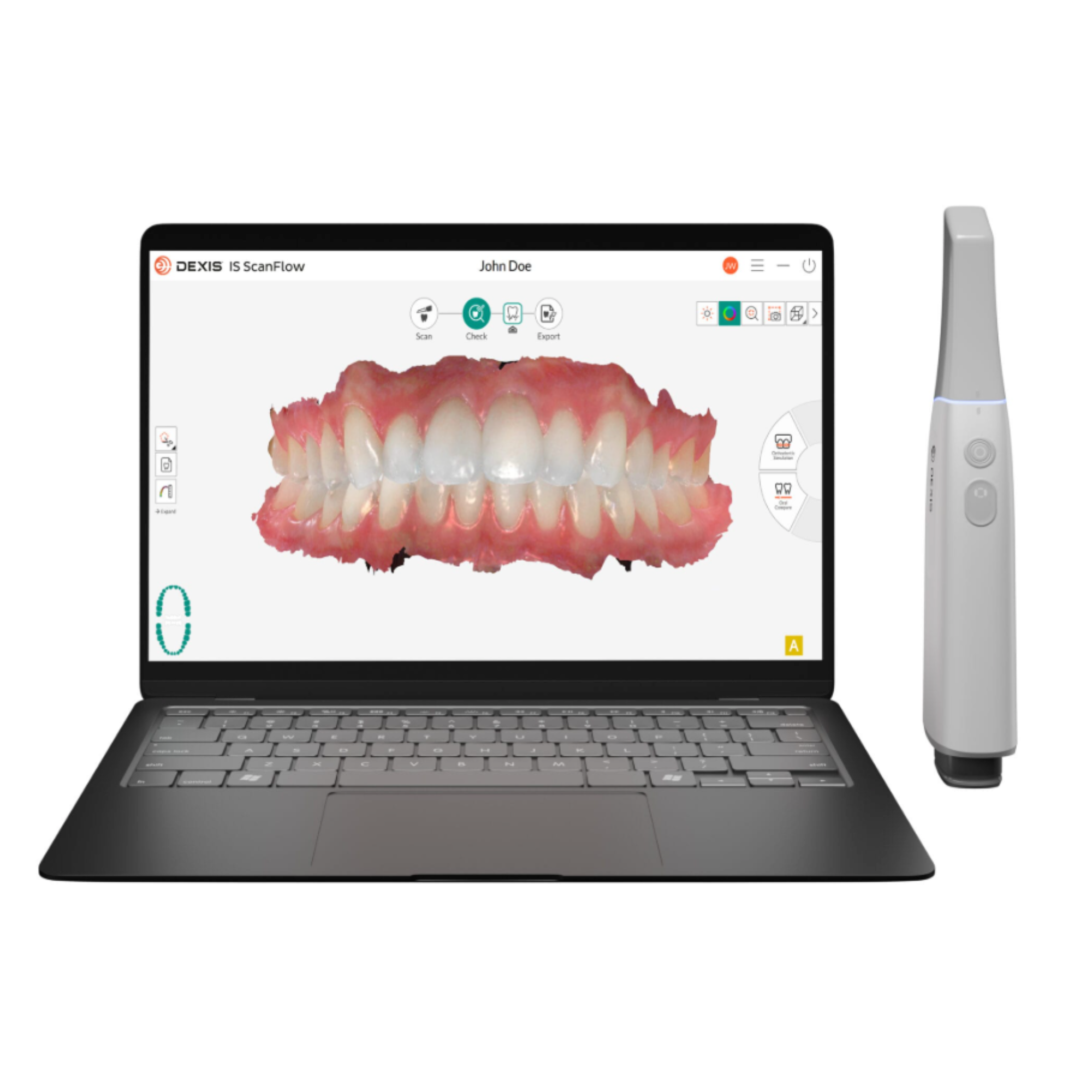 DEXIS Imprevo Intraoral Scanner